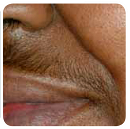 hair 3