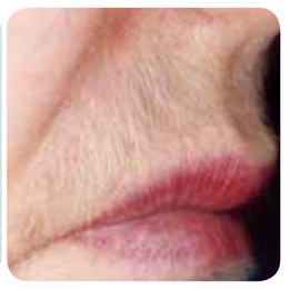 hair 5