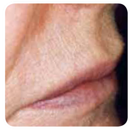 hair 6