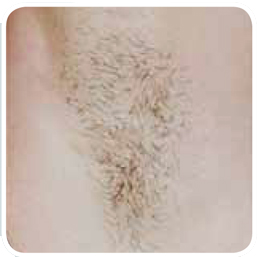 hair 7