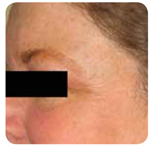 photo4
