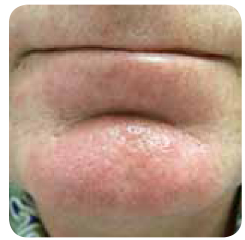 photo6